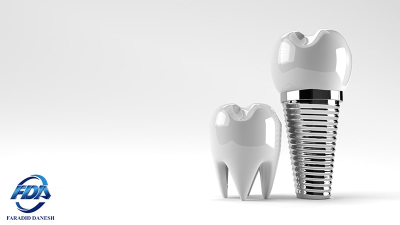 انواع ایمپلنت دندان کره ای