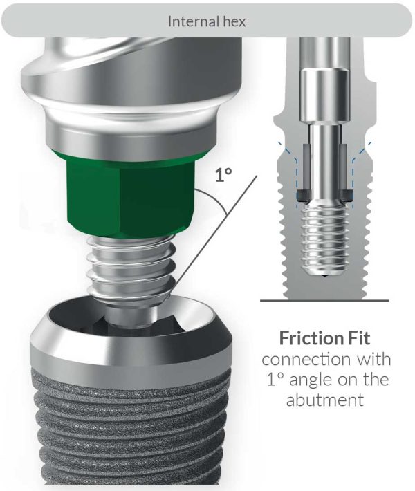 ایمپلنت دندانپزشکی سوئیسی ires