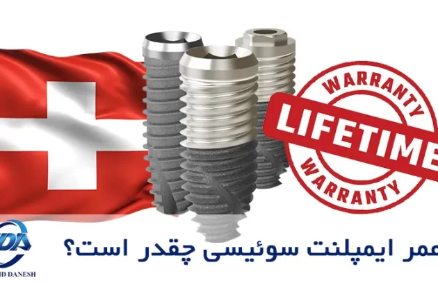 ایمپلنت سوئیسی چقدر دوام دارد؟