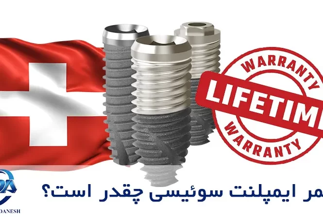 ایمپلنت سوئیسی چقدر دوام دارد؟